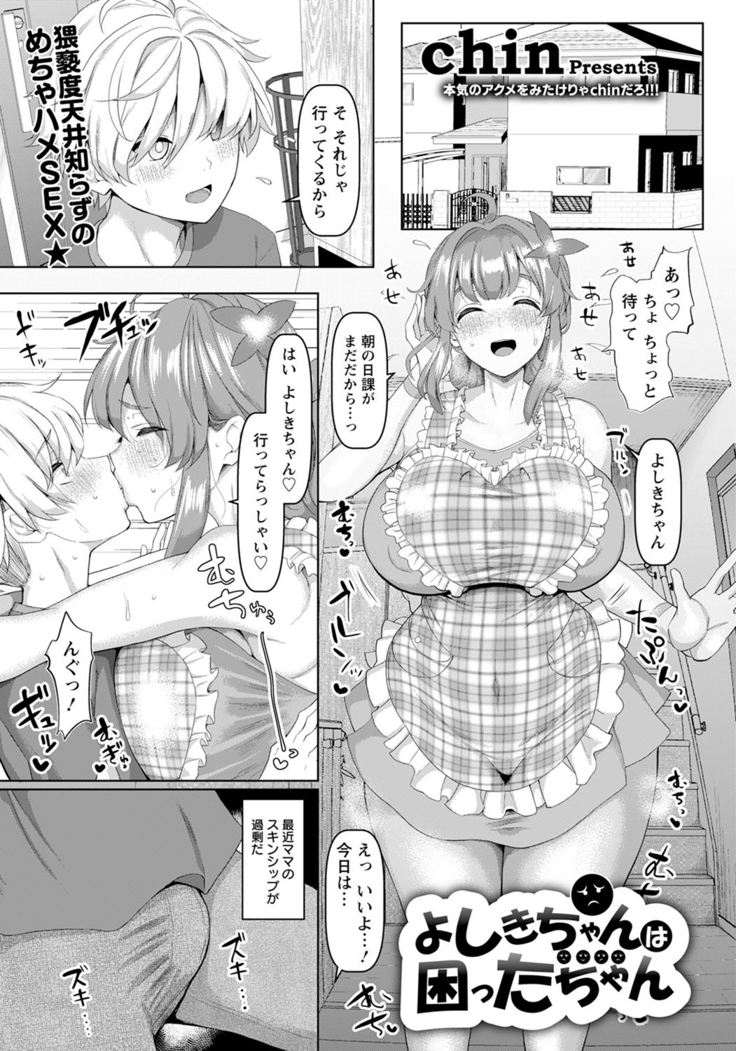 Yoshiki-chan wa komattachan page 1 full